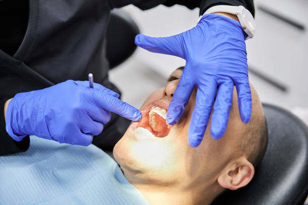 Best Emergency Tooth Extraction in Magnet Cove, AR