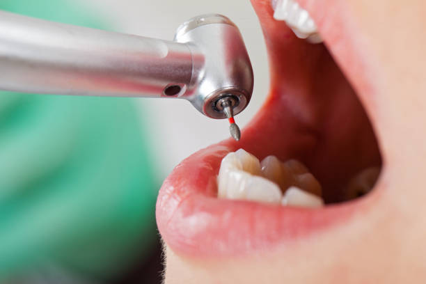 Best Same-Day Emergency Dental Services in Magnet Cove, AR